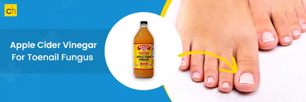 10 Effective & Natural Cure For Toenail Fungus