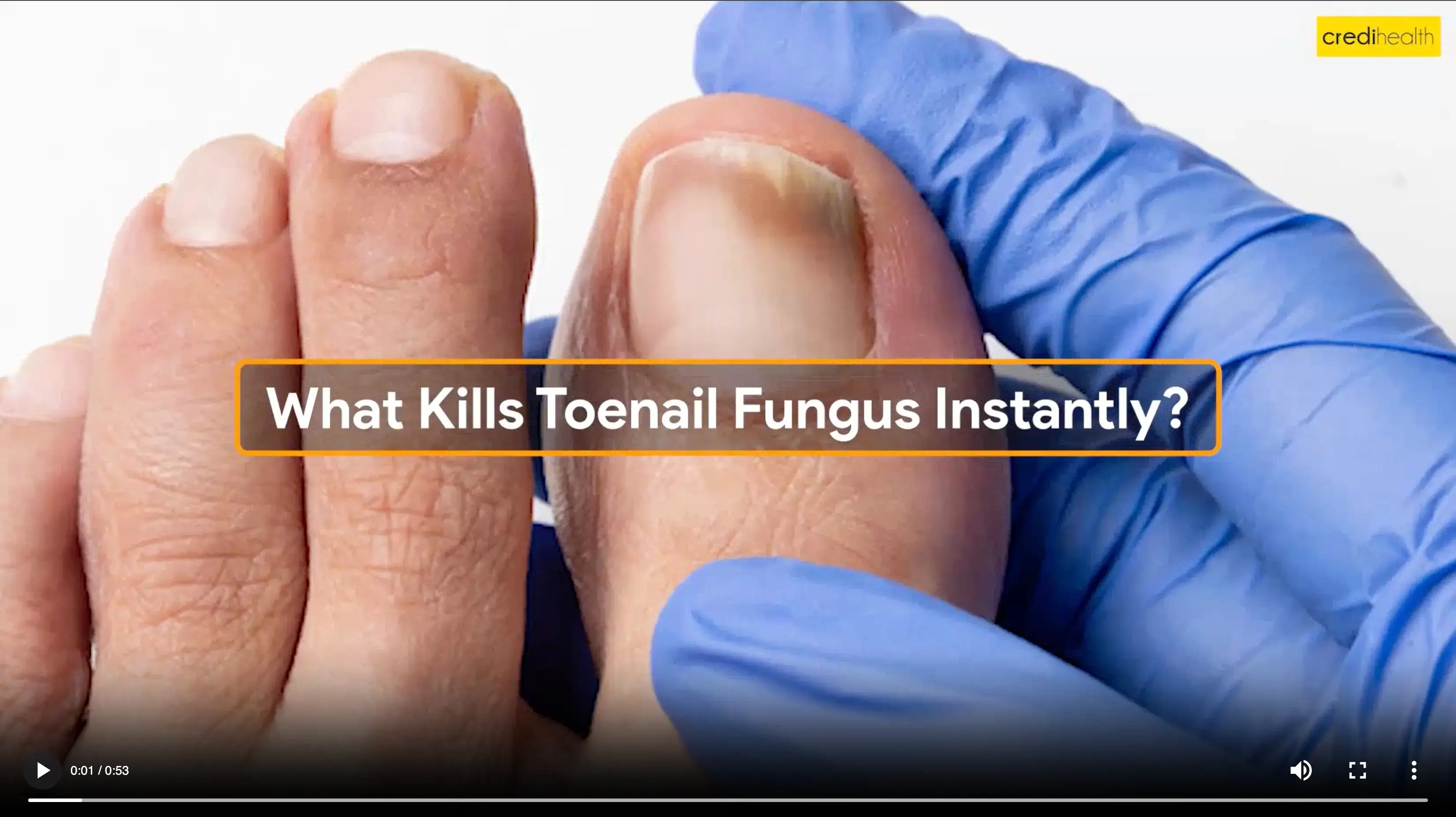 How to Prevent and Treat Toenail Fungus - FASA