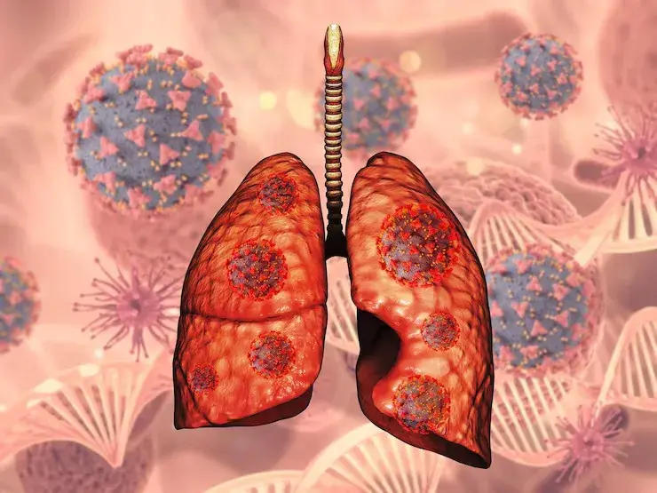 Is upper respiratory infection contagious