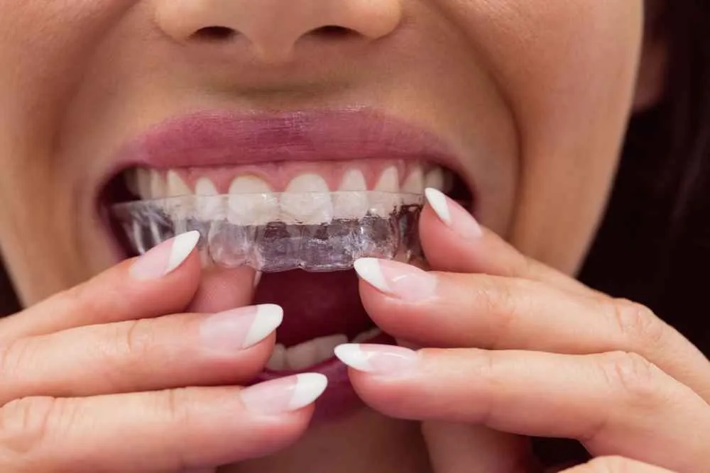 A Beautiful Smile: Everything You Need to...