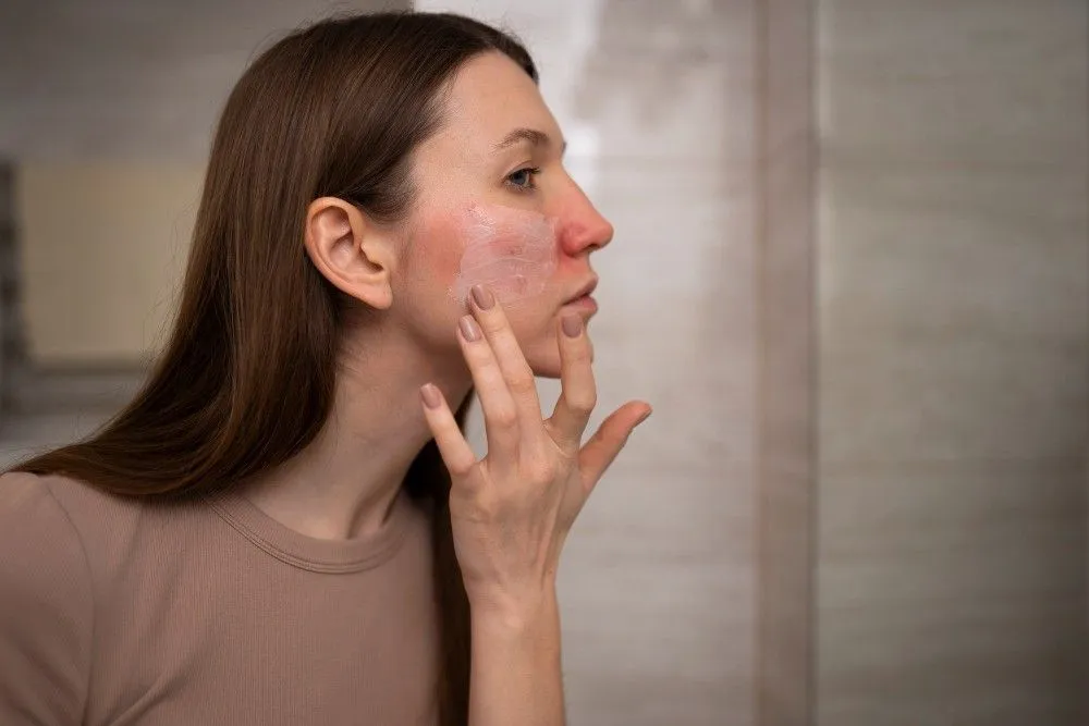 Hidradenitis Suppurativa Treatment: How t...