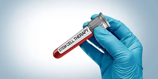 How Stem Cell Therapy in Chicago Is Chang...