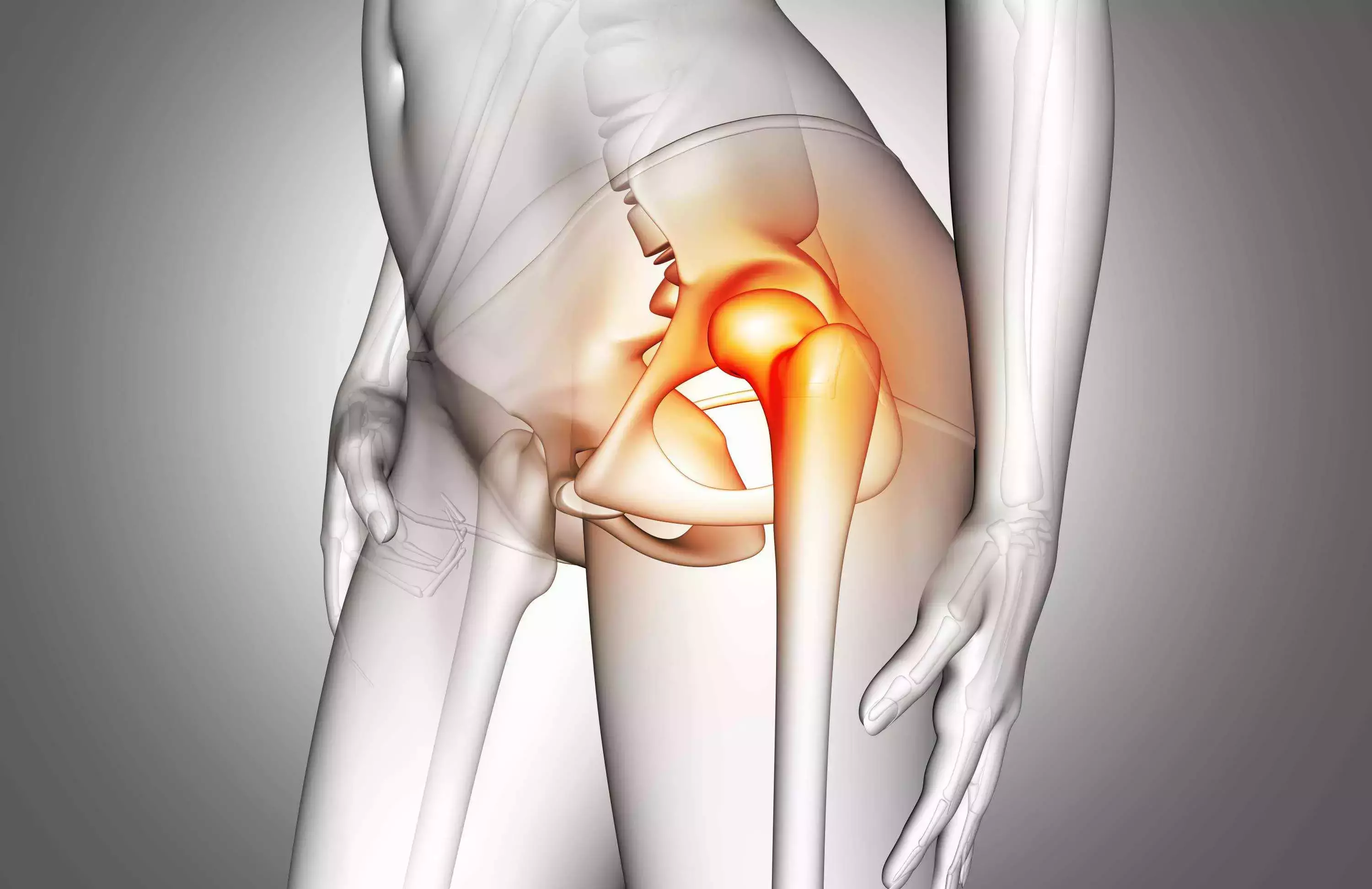 How to Make Piriformis Syndrome Go Away