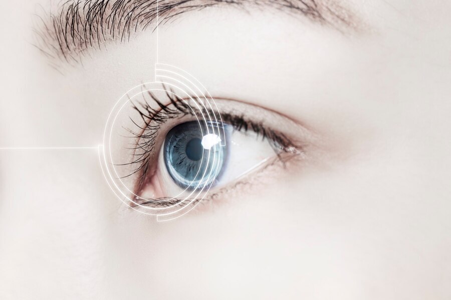 LASIK