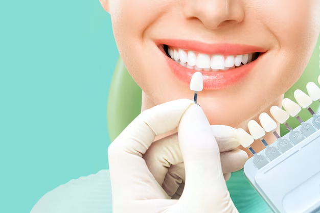 What are the advantages of dental veneers