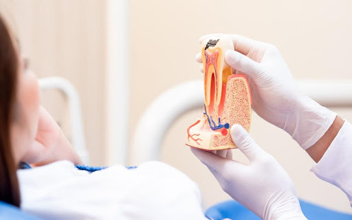 Root Canal Treatment