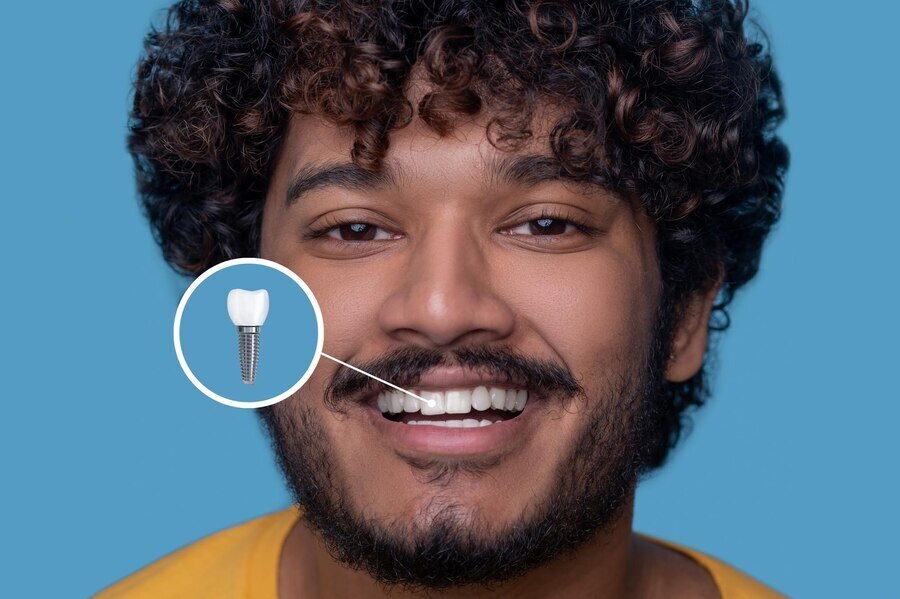 Replacing Missing Teeth