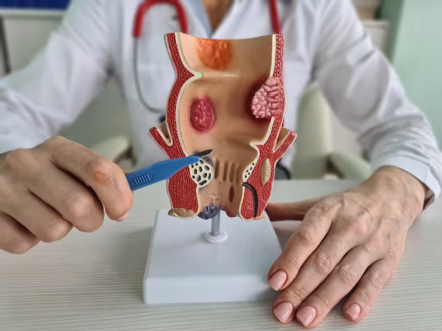 Fistula meaning in Hindi
