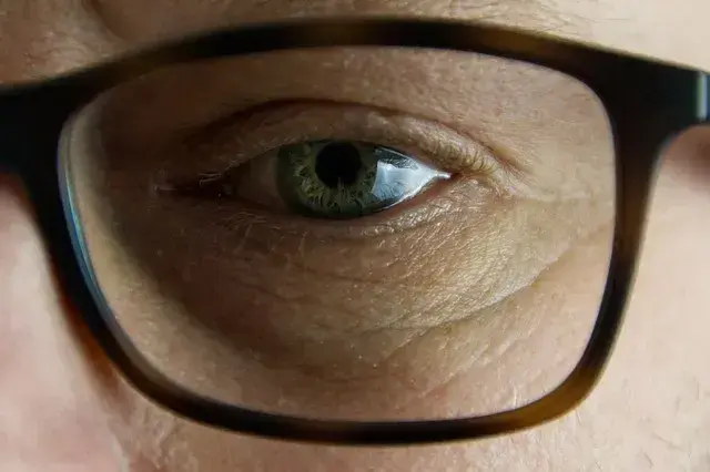 10 Ways to Get Rid of Eye Glasses Permanently