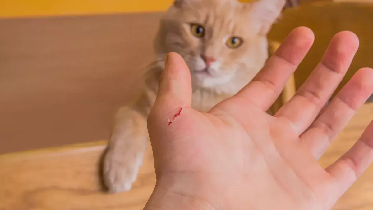 cat scratch fever