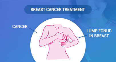 Breast Cancer Treatment Symptoms Of Breast Cancer Crediwiki