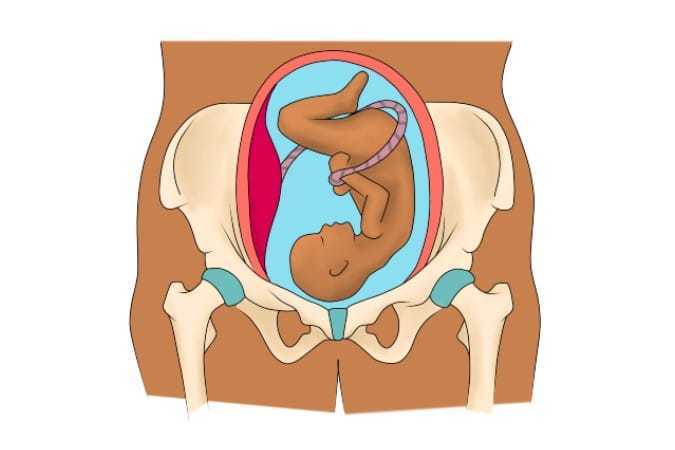 Understanding Symphysis Pubis Dysfunction (SPD) During Pregnancy