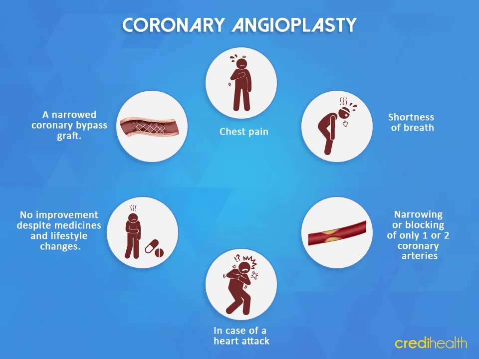 coronary-angioplasty-credihealth