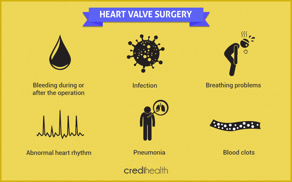 heart valve surgery