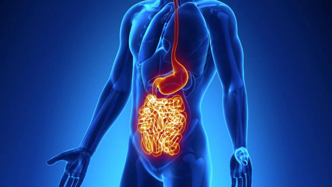 Crohn's Disease Diet: Foods To Eat And Avoid