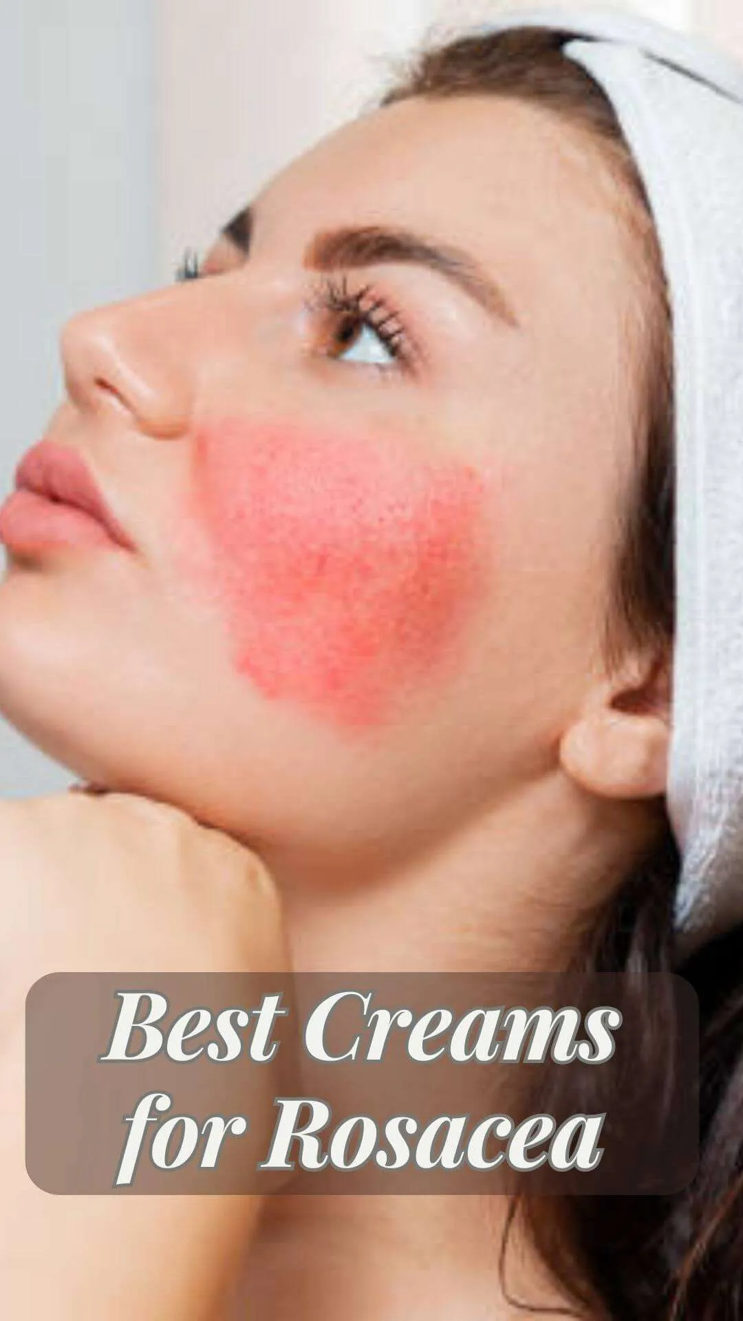 10 Best Creams for Rosacea in 2023