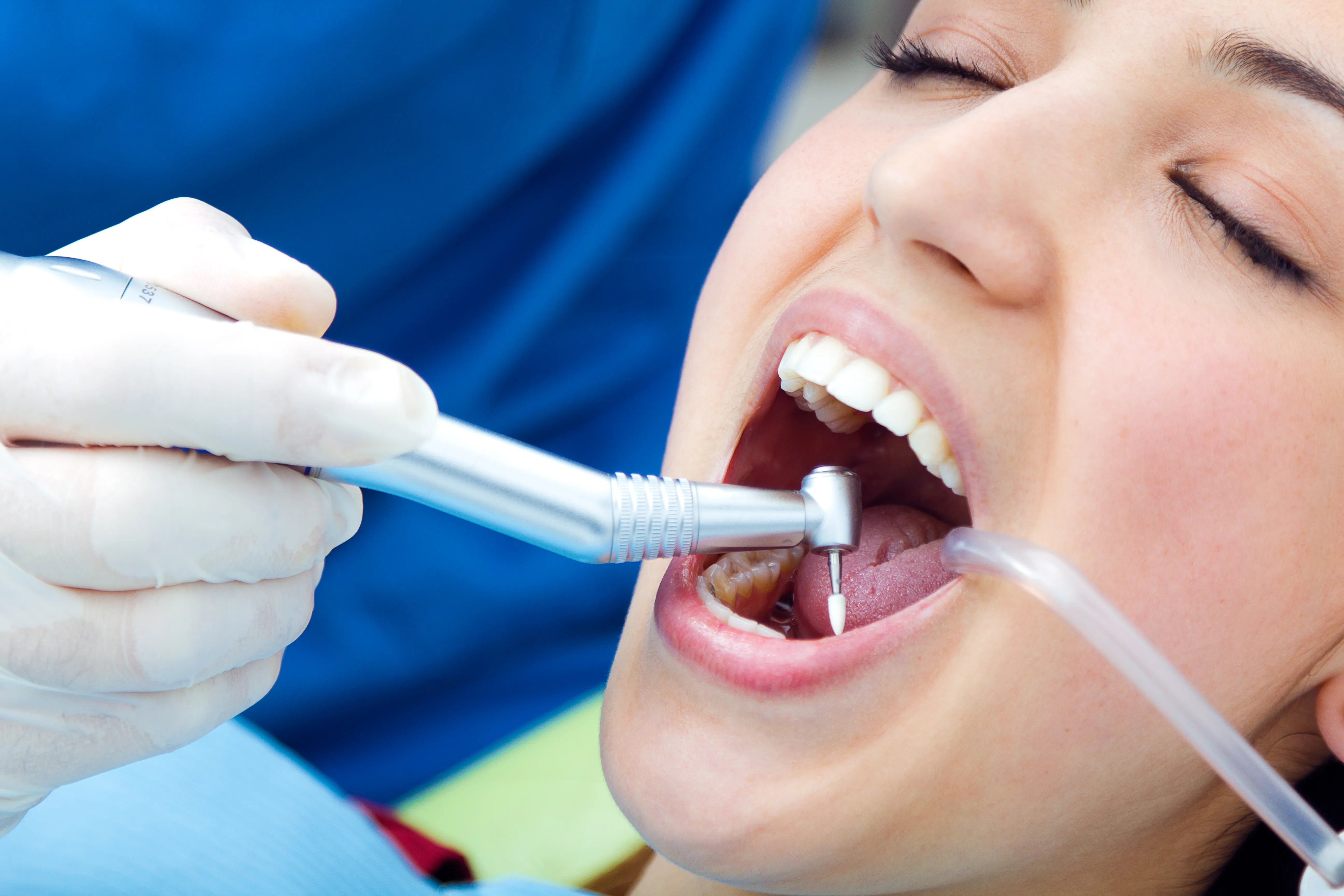 Top 4 Benefits of Dental Implants