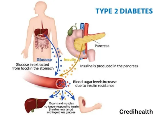 9 Unique Symptoms of Type-2 Diabetes.