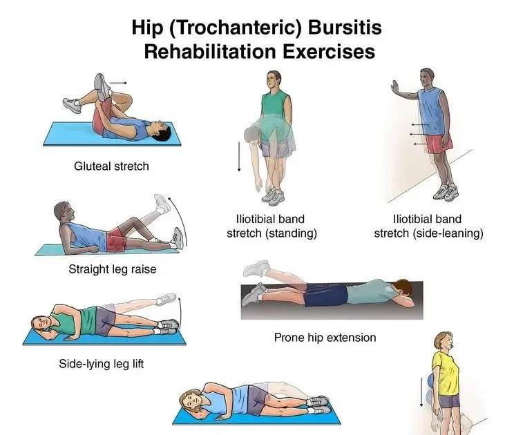 10 Best Exercises For Hip Bursitis Relief Credihealth