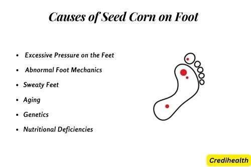 Causes of Seed Corn on Foot