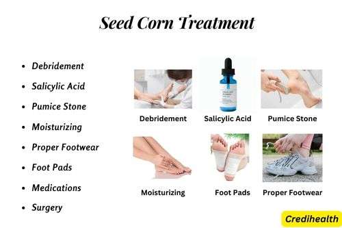 Seed Corn Treatment - Seed Corn on Feet