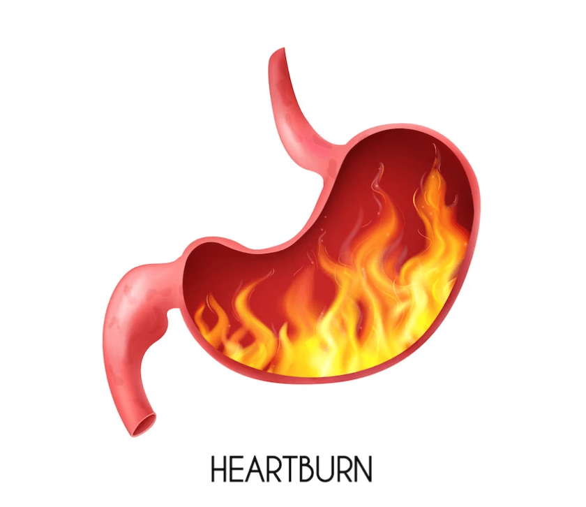 What is Heartburn, what causes heartburn everyday, heartburn everyday, what causes heartburn