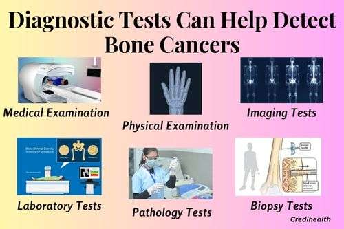 Diagnostic Tests Can Help Detect Bone Cancers - how long can you have bone cancer without knowing