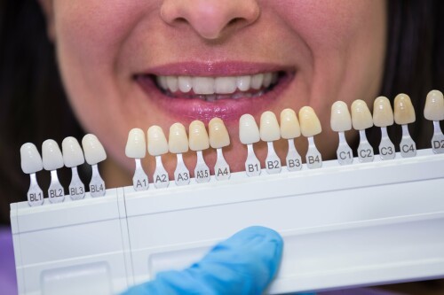 Types of Restorative Dentistry, Dental Implants